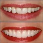 La imagen 1 de la Empresa AS CLINICA DENTAL ORTODONCIAS LINGUALES en Ñuñoa RM