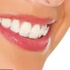 La imagen 2 de la Empresa AS CLINICA DENTAL ORTODONCIAS LINGUALES en Ñuñoa RM