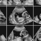 La imagen 2 de la Empresa CENTRO ECOGRAFICO DR. RAÚL SAINT-JEAN H. ECOTOMOGRAFIAS OBSTETRICAS en Concepción BI