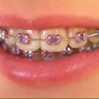 La imagen 1 de la Empresa CLÍNICA DENTAL ARTIFICIO Urgencias Dentales en Calera VS