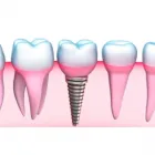 La imagen 2 de la Empresa CLÍNICA DENTAL ARTIFICIO Urgencias Dentales en Calera VS