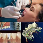 La imagen 2 de la Empresa CLINICA DENTAL SAN JAVIER LIMITADA Estetica Dental en Viña del Mar VS
