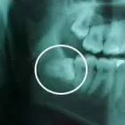 La imagen 2 de la Empresa CLÍNICAS DENTALES DIGITALDENT LTDA Urgencias en Viña del Mar VS