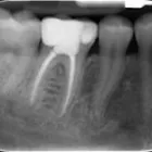 La imagen 3 de la Empresa CLÍNICAS DENTALES DIGITALDENT LTDA Urgencias en Viña del Mar VS
