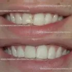 La imagen 5 de la Empresa CLÍNICAS DENTALES DIGITALDENT LTDA Urgencias en Viña del Mar VS