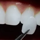 La imagen 7 de la Empresa CLÍNICAS DENTALES DIGITALDENT LTDA Urgencias en Viña del Mar VS