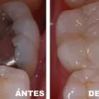 La imagen 9 de la Empresa CLÍNICAS DENTALES DIGITALDENT LTDA Urgencias en Viña del Mar VS
