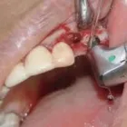 La imagen 11 de la Empresa CLÍNICAS DENTALES DIGITALDENT LTDA Urgencias en Viña del Mar VS