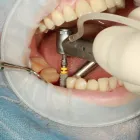 La imagen 5 de la Empresa DENTAL CONTRERAS GROLLMUS Odontologia en Concepción BI