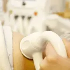 La imagen 4 de la Empresa DERMAPIEL, CENTRO MEDICO ESTETICO Tratamientos para el Acne en Santiago RM