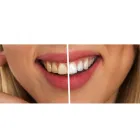 La imagen 3 de la Empresa DR. JUAN CARLOS CARRILLO ORTODONCIA Periodoncia en Valdivia LR