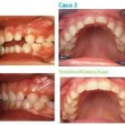 La imagen 5 de la Empresa DR. RAÚL ESCOBAR DONOSO Ortodoncia Adultos en Concepción BI