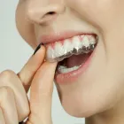 La imagen 2 de la Empresa DRA. KAREM PANTOJA V. TRATAMIENTO DE BRACKETS en Concepción BI