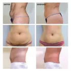 La imagen 10 de la Empresa MASAGIK Tratamientos Esteticos en Santiago RM