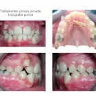La imagen 2 de la Empresa ODONTOLOGIA ALTO SANTIAGO Tratamientos Dentales en Santiago RM