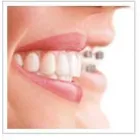 La imagen 3 de la Empresa ODONTOLOGIA ALTO SANTIAGO Tratamientos Dentales en Santiago RM