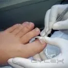 La imagen 2 de la Empresa PODOLOGIA CLINICA  APOQUINDO Uñas Encarnadas en Las Condes RM