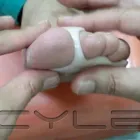 La imagen 3 de la Empresa PODOLOGIA CLINICA  APOQUINDO Uñas Encarnadas en Las Condes RM