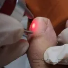 La imagen 4 de la Empresa PODOLOGIA CLINICA  APOQUINDO Uñas Encarnadas en Las Condes RM