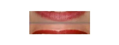 La imagen 1 de la Empresa AS CLINICA DENTAL ORTODONCIAS LINGUALES en Ñuñoa RM