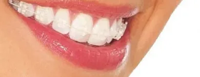 La imagen 2 de la Empresa AS CLINICA DENTAL ORTODONCIAS LINGUALES en Ñuñoa RM