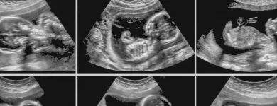 La imagen 2 de la Empresa CENTRO ECOGRAFICO DR. RAÚL SAINT-JEAN H. ECOTOMOGRAFIAS OBSTETRICAS en Concepción BI