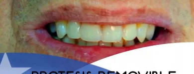 La imagen 3 de la Empresa CLÍNICA DENTAL EXPRESS Ortodoncia en Providencia RM