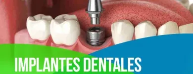 La imagen 4 de la Empresa CLÍNICA DENTAL EXPRESS Ortodoncia en Providencia RM