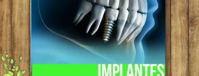 La imagen 5 de la Empresa CLÍNICA DENTAL EXPRESS Ortodoncia en Providencia RM