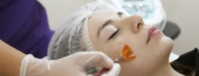 La imagen 5 de la Empresa DERMAPIEL, CENTRO MEDICO ESTETICO Tratamientos para el Acne en Santiago RM