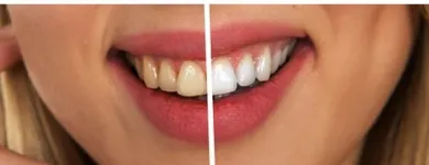 La imagen 3 de la Empresa DR. JUAN CARLOS CARRILLO ORTODONCIA Periodoncia en Valdivia LR