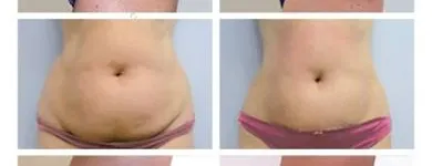 La imagen 10 de la Empresa MASAGIK Tratamientos Esteticos en Santiago RM