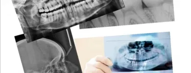 La imagen 3 de la Empresa RXDENT Radiologia en Valparaíso VS