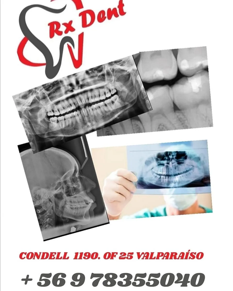La imagen 3 de la Empresa RXDENT