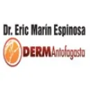 DR. ERICK MARÍN - DERMATÓLOGO Rosacea en Antofagasta AN